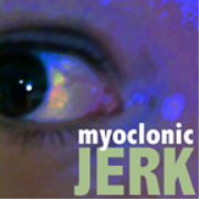 Myoclonic Jerk